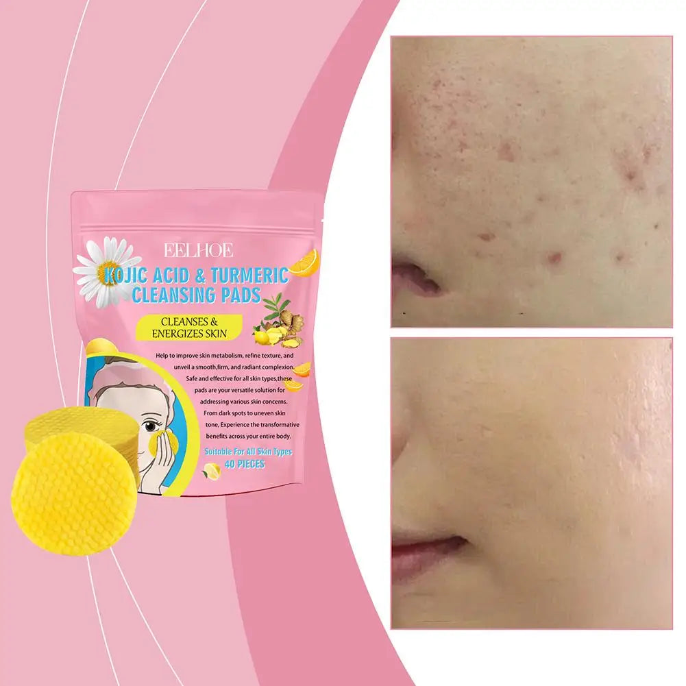 40/50 stücke Kurkuma Reinigung Pad Reinigung Tablet Peeling Pads Gesichts Schwämme Für Peeling Tägliche Reinigung Hautpflege